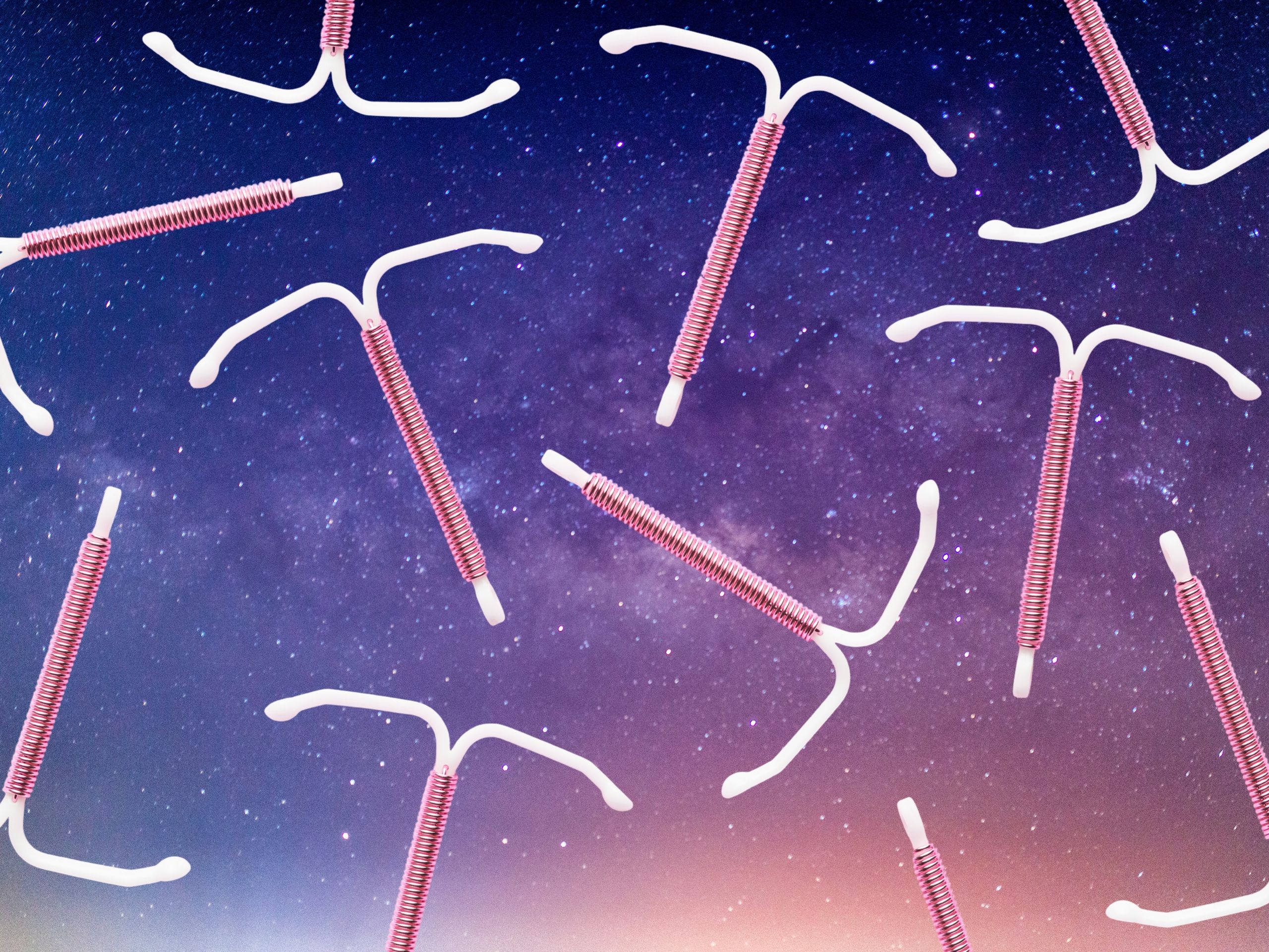 I Got Sedated for IUD Insertion Pain—Heres What Its Like