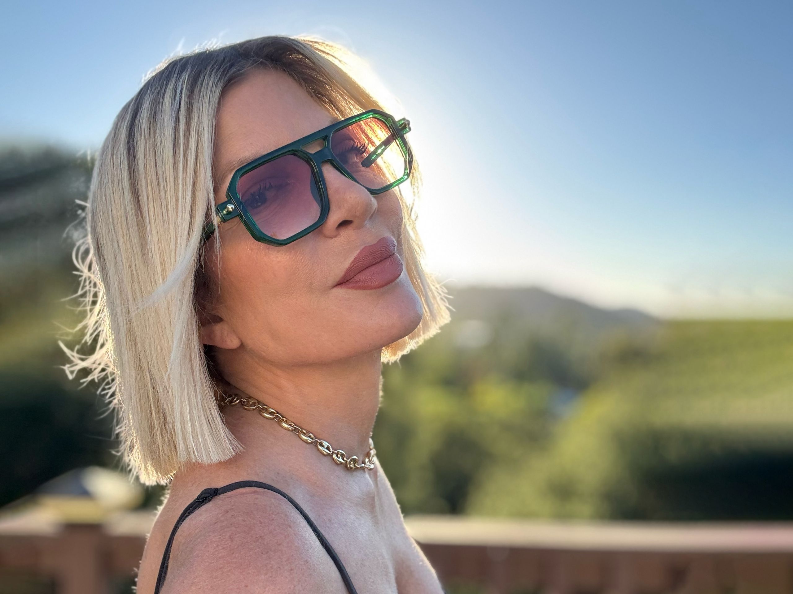 tori spelling eczema campaign